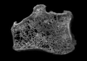 Section of Radius (osteopenia) Section of Radius (osteopenia)
