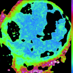 Fluorescence Lifetime Image of Vein Section