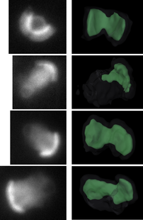 2-D projections (left) and corresponding 1interactive 3-D reconstructions (right) of unconstrained beads (15-µm spacers) showing bilobed and trilobed structure.